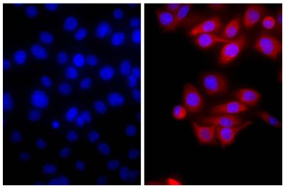 Human pancreatic carcinoma cell line MIA PaCa-2 was stained with Mouse Anti-Cytokeratin 18-UNLB (SB Cat. No. 10085-01; right) followed by Goat Anti-Mouse IgG(H+L), Rat ads-TXRD (SB Cat. No. 1034-07) and DAPI.