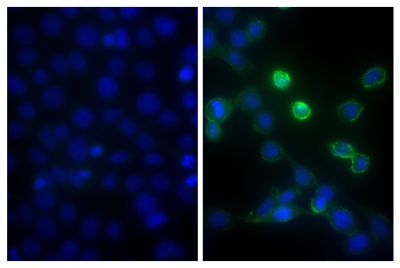 Human pancreatic carcinoma cell line MIA PaCa-2 was stained with Mouse Anti-Human CD44-BIOT (SB Cat. No. 9400-08; right) followed by Streptavidin-FITC (SB Cat. No. 7100-02), DAPI, and mounted with Fluoromount-G<sup>&reg;</sup> Anti-Fade (SB Cat. No. 0100-35).