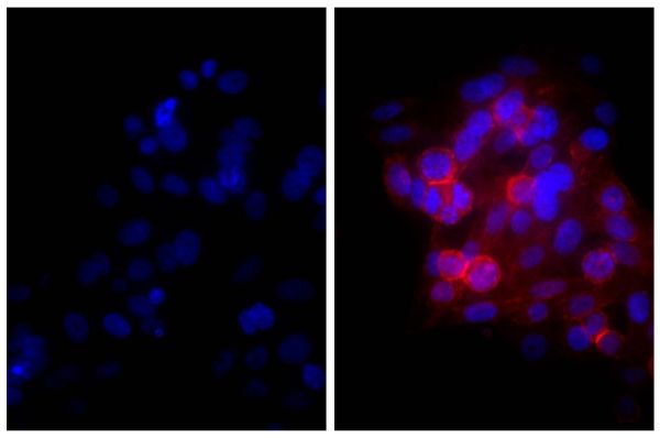 Human epithelial carcinoma cell line HEp-2 was stained with Mouse Anti-Human CD44-UNLB (SB Cat. No. 9400-01; right) followed by Goat Anti-Mouse IgG(H+L), Human ads-TXRD (SB Cat. No. 1031-07) and DAPI.