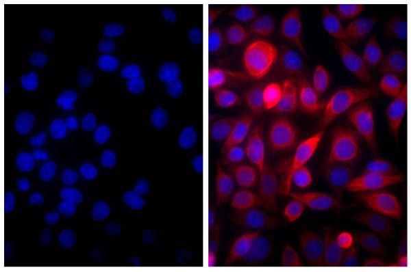 Human pancreatic carcinoma cell line MIA PaCa-2 was blocked with 10% Normal Goat Serum (SB Cat. No. 0060-01) and stained with Mouse Anti-Cytokeratin 18-UNLB (SB Cat. No. 10085-01; right) followed by Goat Anti-Mouse IgG(H+L), Human ads-AF555 (SB Cat. No. 1