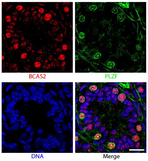 Paraffin embedded sections of mouse P8 testes were stained with anti-BCAS2 and anti-PLZF.  The DNA was stained with Hoechst 33342 and mounted with Fluoromount-G<sup>®</sup> (SB Cat. No. 0100-01).<br/>Images from Liu W, Wang F, Xu Q, Shi J, Zhang X, Li