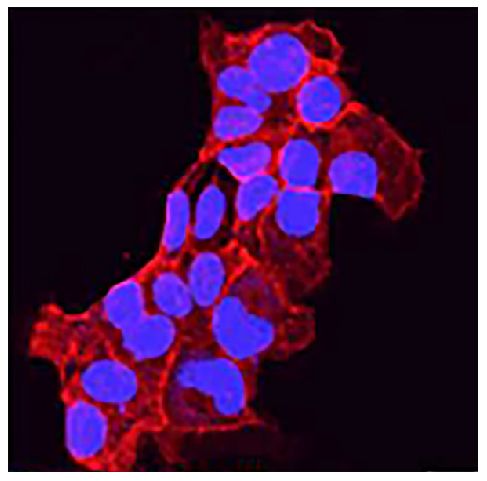 HCC827 cells were stained with anti-E-cadherin followed by a secondary antibody and mounted with DAPI Fluoromount-G<sup>®</sup> (SB Cat. No. 0100-20).<br/>Image from Narita M, Shimura E, Nagasawa A, Aiuchi T, Suda Y, Hamada Y, et al. Chronic treatment