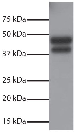 Total cell lysates from Jurkat cells were resolved by electrophoresis, transferred to PVDF membrane, and probed with Rabbit Anti-Human DR5-UNLB (SB Cat. No. 6600-01).  Proteins were visualized using Goat Anti-Rabbit IgG(H+L), Mouse/Human ads-HRP (SB Cat. 