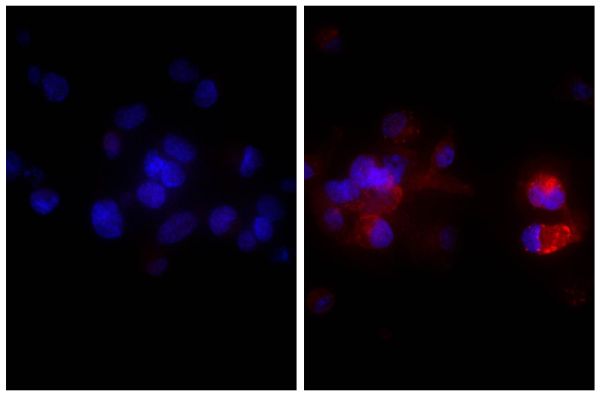 Human hepatocellular carcinoma cell line Hep G2 was stained with Rabbit IgG-UNLB isotype control  (SB Cat. No. 0111-01; left) and Rabbit Anti-Human DR5-UNLB (SB Cat. No. 6600-01; right) followed by Donkey Anti-Rabbit IgG(H+L), Mouse/Rat/Human SP ads-AF555