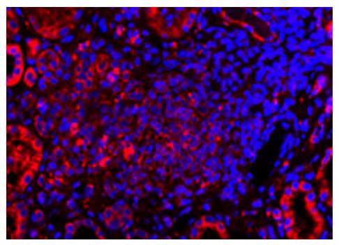 Paraffin embedded human kidney section from AAV patient was stained with anti-C5L2 followed by Goat Anti-Rabbit IgG(H+L), Mouse/Human ads-TRITC (SB Cat. No. 4050-03) and DAPI.<br/>Image from Yuan J, Gou S, Huang J, Hao J, Chen M, Zhao M. C5a and its recep