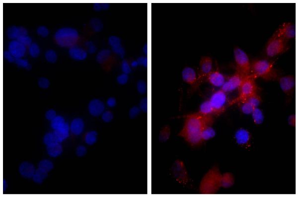 Human hepatocellular carcinoma cell line Hep G2 was stained with Rabbit IgG-UNLB isotype control (SB Cat. No. 0111-01; left) and Rabbit Anti-Human DR5-UNLB (SB Cat. No. 6600-01; right) followed by Donkey Anti-Rabbit IgG(H+L), Mouse/Rat/Human SP ads-BIOT (
