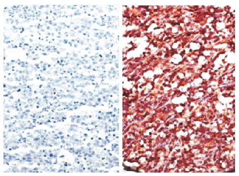 Paraffin embedded AIDS-associated Burkitt lymphoma tissue array was stained with anti-CXCR5 (right) and Rat IgG<sub>2b</sub>-UNLB (SB Cat. No. 0118-01; left) followed by a secondary antibody and Fast Red.<br/>Images from Widney DP, Gui D, Popoviciu LM, Sa