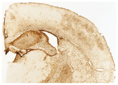 Free-floating Bcs1lc.232A>G mouse cerebral cortex cryosection was stained with anti-GFAP followed by secondary reagents, DAB, and mounted on Gelatin Subbed Slides (SB Cat. No. SLD01).<br/>Image from Tegelberg S, Tomašić N, Kallijärvi J, Purhonen J, Elmér 