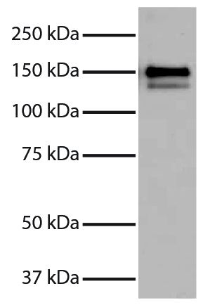 Purified Human Type I Collagen (SB Cat. No. 1200-01S) was resolved by electrophoresis, transferred to PVDF membrane, probed with Goat Anti-Type I Collagen-UNLB (SB Cat. No. 1310-01), and visualized using Donkey Anti-Goat IgG(H+L), Multi-Species SP ads-HRP