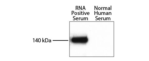 RNA helicase A (RHA) positive and normal human serum was resolved by electrophoresis, transferred to nitrocellulose membrane, and probed with anti-RHA followed by Goat F(ab')<sub>2</sub> Anti-Rabbit IgG(H+L), Mouse/Human ads-HRP (SB Cat. No. 4052-05) and 