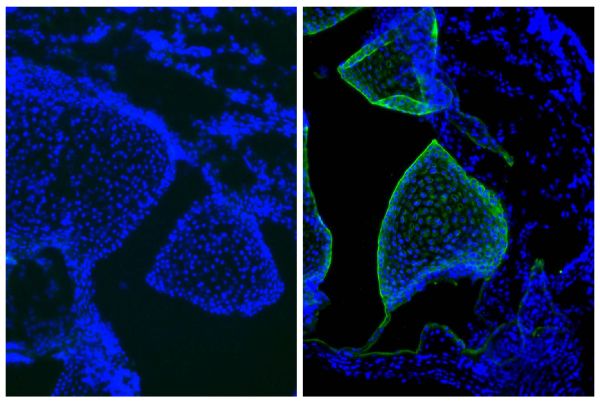 Frozen newborn mouse cartilage section was stained with Mouse IgG<sub>1</sub>-UNLB isotype control (SB Cat. No. 0102-01; left) and Mouse Anti-Type II Collagen-UNLB (right) followed by Goat Anti-Mouse IgG<sub>1</sub>, Human ads-FITC (SB Cat. No. 1070-02) a