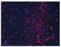 Human dermal fibroblasts stimulated with unstimulated macrophages for 72 h were stained with anti-collagen type I followed by Goat Anti-Mouse IgG<sub>1</sub>, Human ads-BIOT (SB Cat. No. 1070-08), CY3 conjugated Streptavidin, and DAPI.<br/>Image from Ploe