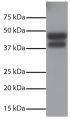 Total cell lysates from Jurkat cells were resolved by electrophoresis, transferred to PVDF membrane, and probed with Rabbit Anti-Human DR5-UNLB (SB Cat. No. 6600-01).  Proteins were visualized using Goat Anti-Rabbit IgG(H+L), Mouse/Human ads-HRP (SB Cat. 