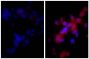 Human hepatocellular carcinoma cell line Hep G2 was stained with Rabbit IgG-UNLB isotype control (SB Cat. No. 0111-01; left) and Rabbit Anti-Human DR5-UNLB (SB Cat. No. 6600-01; right) followed by Donkey Anti-Rabbit IgG(H+L), Mouse/Rat/Human SP ads-BIOT (