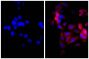 Human pancreatic carcinoma cell line MIA PaCa-2 was stained with Mouse Anti-Cytokeratin 18-UNLB (SB Cat. No. 10085-01; right) followed by Goat Anti-Mouse IgG(H+L), Rat ads-AF555 (SB Cat. No. 1034-32) and DAPI.