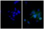 Human epithelial carcinoma cell line HEp-2 was stained with Mouse Anti-Human CD44-UNLB (SB Cat. No. 9400-01; right) followed by Goat Anti-Mouse IgG, Human ads-BIOT (SB Cat. No. 1030-08), Streptavidin-FITC (SB Cat. No. 7100-02), and DAPI.