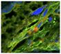 Zika virus (ZIKV) inoculated frozen mouse placenta was stained with anti-flaviviruses and anti-cytokeratin.  The DNA was stained with DAPI and mounted with Fluoromount-G<sup>®</sup> (SB Cat. No. 0100-01).<br/>Image from Vermillion MS, Lei J, Shabi Y, 