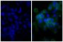 Human epithelial carcinoma cell line HEp-2 was stained with Mouse Anti-Human CD44-UNLB (SB Cat. No. 9400-01; right) followed by Goat Anti-Mouse IgG(H+L), Human ads-BIOT (SB Cat. No. 1031-08), Streptavidin-FITC (SB Cat. No. 7100-02), and DAPI.