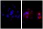 Human hepatocellular carcinoma cell line Hep G2 was stained with Rabbit IgG-UNLB isotype control  (SB Cat. No. 0111-01; left) and Rabbit Anti-Human DR5-UNLB (SB Cat. No. 6600-01; right) followed by Donkey Anti-Rabbit IgG(H+L), Mouse/Rat/Human SP ads-AF555