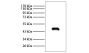 Proteins derived from outer membrane vesicles of patients with kidney stones were resolved by electrophoresis, transferred to PVDF membrane, and probed with anti-EF-Tu followed by Rabbit Anti-Mouse IgG(H+L)-HRP (SB Cat. No. 6170-05) and chemiluminescent d