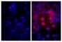 Human pancreatic carcinoma cell line MIA PaCa-2 was stained with Mouse Anti-Human CD44-BIOT (SB Cat. No. 9400-08; right) followed by Streptavidin-TXRD (SB Cat. No. 7100-07), DAPI, and mounted with Fluoromount-G<sup>®</sup> Anti-Fade (SB Cat. No. 0100-
