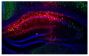 Frozen section of Pvalb-IRES-CRE mouse CA1 hippocampus injected with AAV-hM4Di-mCherry was stained with anti-parvalbumin followed by a secondary antibody and mounted with DAPI Fluoromount-G<sup>®</sup> (SB Cat. No. 0100-20).<br/>Image from Ognjanovski