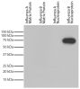 Recombinant influenza proteins were resolved by electrophoresis, transferred to PVDF membrane, and probed with Mouse Anti-Influenza B, Nucleoprotein-HRP (SB Cat. No. 10885-05).  Proteins were visualized with chemiluminescent detection.