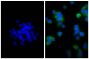 Human pancreatic carcinoma cell line MIA PaCa-2 was stained with Mouse Anti-Cytokeratin 18-UNLB (SB Cat. No. 10085-01; right) followed by Goat F(ab')<sub>2</sub> Anti-Mouse IgG(H+L), Human ads-BIOT (SB Cat. No. 1032-08), Streptavidin-FITC (SB Cat. No. 710