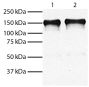 Total cell lysates from HEp-2 (Lane 1) and MIA PaCa-2 (Lane 2) cells were resolved by electrophoresis, transferred to PVDF membrane, and probed with Mouse Anti-Human EGFR-UNLB (SB Cat. No. 10400-01).  Proteins were visualized using Goat Anti-Mouse IgG, Hu