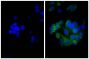 Human pancreatic carcinoma cell line MIA PaCa-2 was stained with Mouse Anti-Cytokeratin 18-UNLB (SB Cat. No. 10085-01; right) followed by Goat Anti-Mouse Kappa-BIOT (SB Cat. No. 1050-08), Streptavidin-FITC (SB Cat. No. 7100-02), and DAPI.