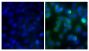 Human pancreatic carcinoma cell line MIA PaCa-2 was stained with Mouse Anti-Human CD44-BIOT (SB Cat. No. 9400-08; right) followed by Streptavidin-CY2 (SB Cat. No. 7100-21), DAPI, and mounted with Fluoromount-G<sup>®</sup> Anti-Fade (SB Cat. No. 0100-3