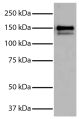 Purified Human Type I Collagen (SB Cat. No. 1200-01S) was resolved by electrophoresis, transferred to PVDF membrane, probed with Goat Anti-Type I Collagen-UNLB (SB Cat. No. 1310-01), and visualized using Donkey Anti-Goat IgG(H+L), Multi-Species SP ads-HRP