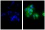 Human epithelial carcinoma cell line HEp-2 was stained with Mouse Anti-Human CD44-UNLB (SB Cat. No. 9400-01; right) followed by Goat Anti-Mouse IgG, Human ads-AF488 (SB Cat. No. 1030-30) and DAPI.