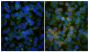 Human epithelial carcinoma cell line HEp-2 was stained with  with Mouse IgG<sub>2a</sub>-UNLB isotype control (SB Cat. No. 0103-01; left) and Mouse Anti-Human EGFR-UNLB (SB Cat. No. 10400-01; right) followed by Goat Anti-Mouse IgG(H+L), Human ads-BIOT (SB