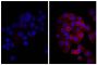 Human pancreatic carcinoma cell line MIA PaCa-2 was stained with Mouse Anti-Human CD44-UNLB (SB Cat. No. 9400-01; right) followed by Donkey Anti-Mouse IgG(H+L), Human SP ads-BIOT (SB Cat. No. 6410-08), Streptavidin-TRITC (SB Cat. No. 7100-03), and DAPI.