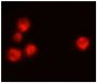 Wdpks1Δ-1 yeast cells treated with liquid nitrogen were stained with anti-melanin followed by Goat Anti-Mouse IgM, Human ads-TRITC (SB Cat. No. 1020-03).<br/>Image from Paolo WF Jr, Dadachova E, Mandal P, Casadevall A, Szaniszlo PJ, Nosanchuk JD. Effects 