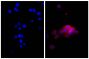 Human pancreatic carcinoma cell line MIA PaCa-2 was stained with Mouse Anti-Cytokeratin 18-UNLB (SB Cat. No. 10085-01; right) followed by Goat Anti-Mouse Kappa-AF555 (SB Cat. No. 1050-32) and DAPI.