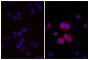 Human pancreatic carcinoma cell line MIA PaCa-2 was stained with Mouse Anti-Human CD44-UNLB (SB Cat. No. 9400-01; right) followed by Donkey Anti-Mouse IgG(H+L), Multi-Species SP ads-BIOT (SB Cat. No. 6415-08), Streptavidin-TXRD (SB Cat. No. 7100-07), and 
