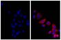 Human pancreatic carcinoma cell line MIA PaCa-2 was stained with Mouse Anti-Cytokeratin 18-UNLB (SB Cat. No. 10085-01; right) followed by Donkey Anti-Mouse IgG(H+L), Multi-Species SP ads-AF555 (SB Cat. No. 6415-32) and DAPI.