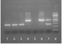 Lane 1 - E. coli Genomic DNA<br/>Lane 2 - Hybridoma Cell DNA<br/>Lane 3 - Negative Control (H<sup>2</sup>O)<br/>Lane 4 - Positive Control<br/>Lane 5 - Inhibited Sample<br/>Lane 6 - Strongly Contaminated <br/>Sample<br/>Lane 7 - Weakly Contaminated Sample<