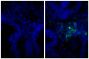 Paraffin embedded human gastric cancer tissue was stained with Rabbit IgG-UNLB isotype control (SB Cat. No. 0111-01; left) and Rabbit Anti-Human IgG(H+L), Mouse ads-UNLB (SB Cat. No. 6145-01; right) followed by Donkey Anti-Rabbit IgG(H+L), Mouse/Rat/Human