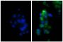 Human hepatocellular carcinoma cell line Hep G2 was stained with Rabbit IgG-UNLB isotype control (SB Cat. No. 0111-01; left) and Rabbit Anti-Human DR5-UNLB (SB Cat. No. 6600-01; right) followed by Donkey Anti-Rabbit IgG(H+L), Mouse/Rat/Human SP ads-FITC (