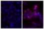 Human pancreatic carcinoma cell line MIA PaCa-2 was stained with Mouse Anti-Human CD44-BIOT (SB Cat. No. 9400-08; right) followed by Streptavidin-CY3 (SB Cat. No. 7100-12), DAPI, and mounted with Fluoromount-G<sup>®</sup> Anti-Fade (SB Cat. No. 0100-3